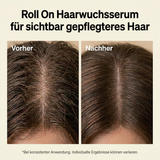 MEVYA Haarwuchsserum Roll-On Vorher-Nachher Vergleich für sichtbar gepflegteres Haar